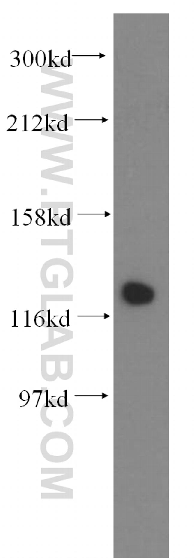 DDB1 Antibody in Western Blot (WB)