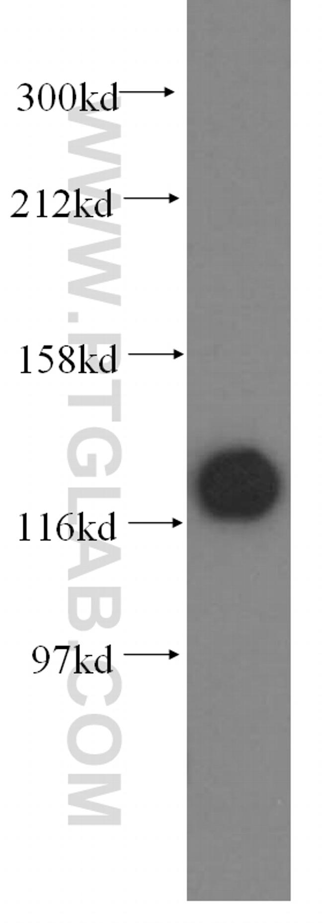 DDB1 Antibody in Western Blot (WB)