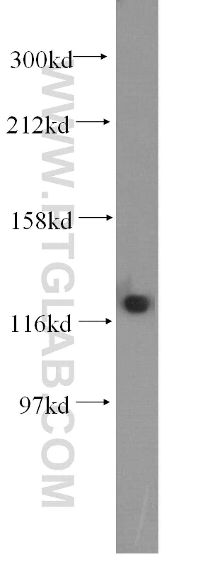 DDB1 Antibody in Western Blot (WB)