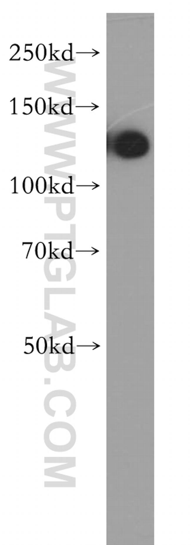 DDB1 Antibody in Western Blot (WB)