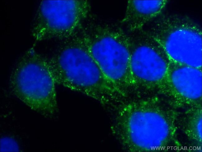 Cortactin Antibody in Immunocytochemistry (ICC/IF)