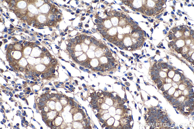 Cortactin Antibody in Immunohistochemistry (Paraffin) (IHC (P))