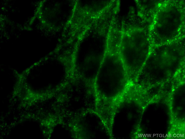 Cortactin Antibody in Immunocytochemistry (ICC/IF)