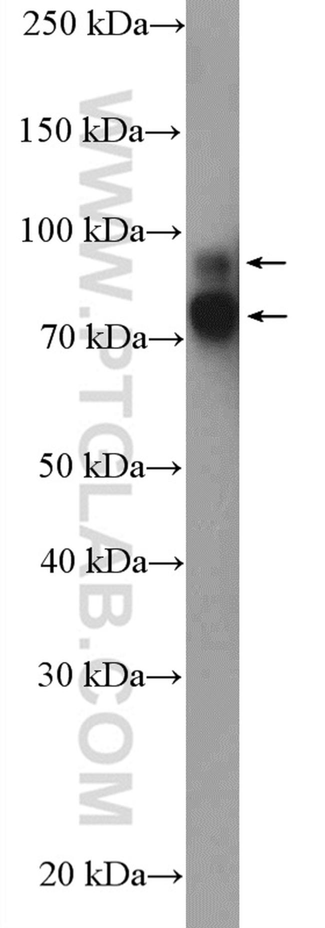 Cortactin Antibody in Western Blot (WB)