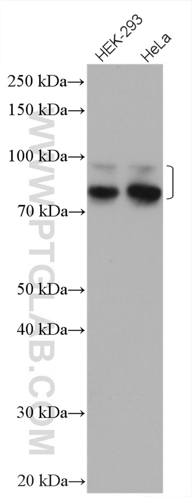 Cortactin Antibody in Western Blot (WB)