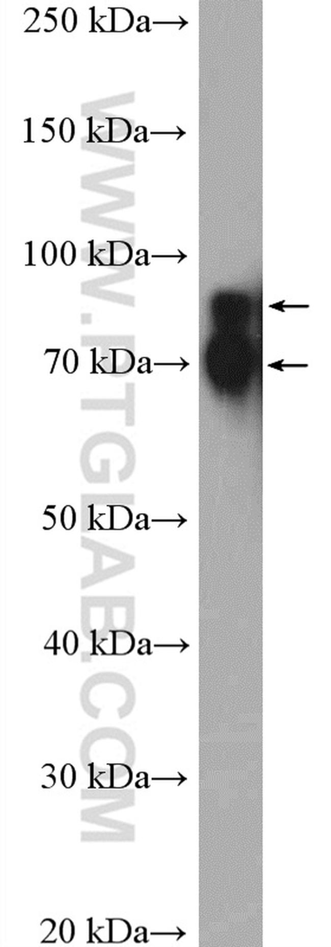 Cortactin Antibody in Western Blot (WB)