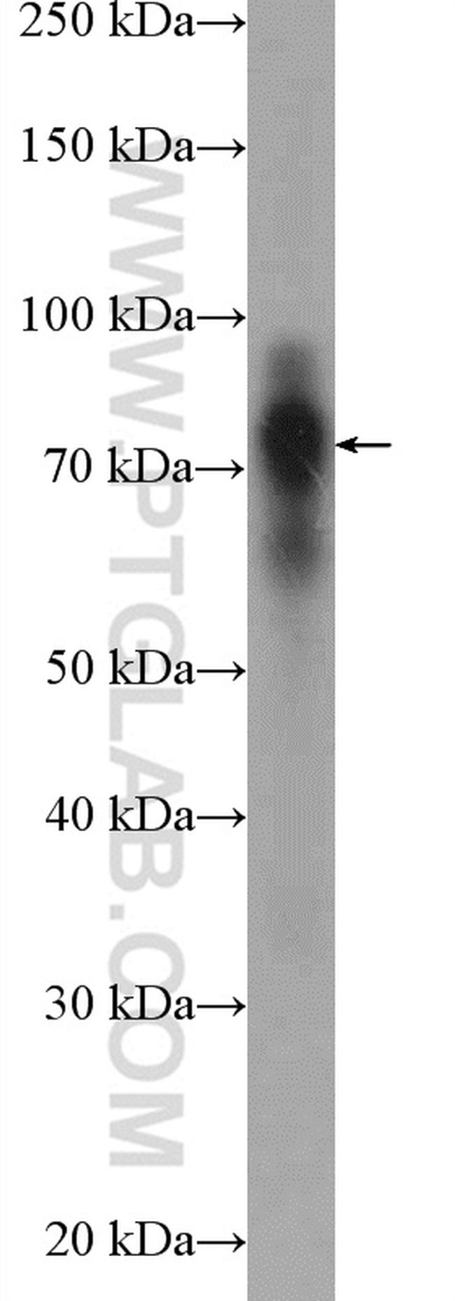 Cortactin Antibody in Western Blot (WB)