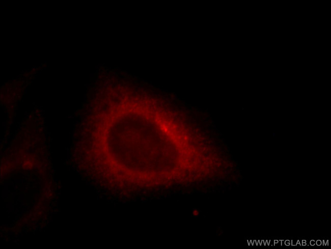 EHD4 Antibody in Immunocytochemistry (ICC/IF)