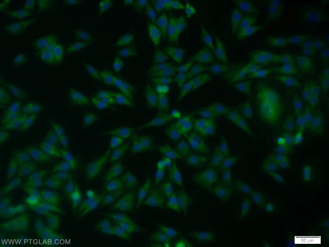 SPRY2 Antibody in Immunocytochemistry (ICC/IF)