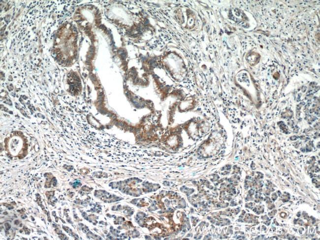 SPRY2 Antibody in Immunohistochemistry (Paraffin) (IHC (P))