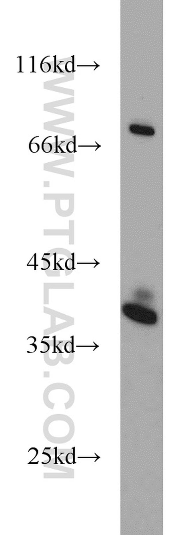 SPRY2 Antibody in Western Blot (WB)