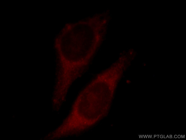 ECH1 Antibody in Immunocytochemistry (ICC/IF)