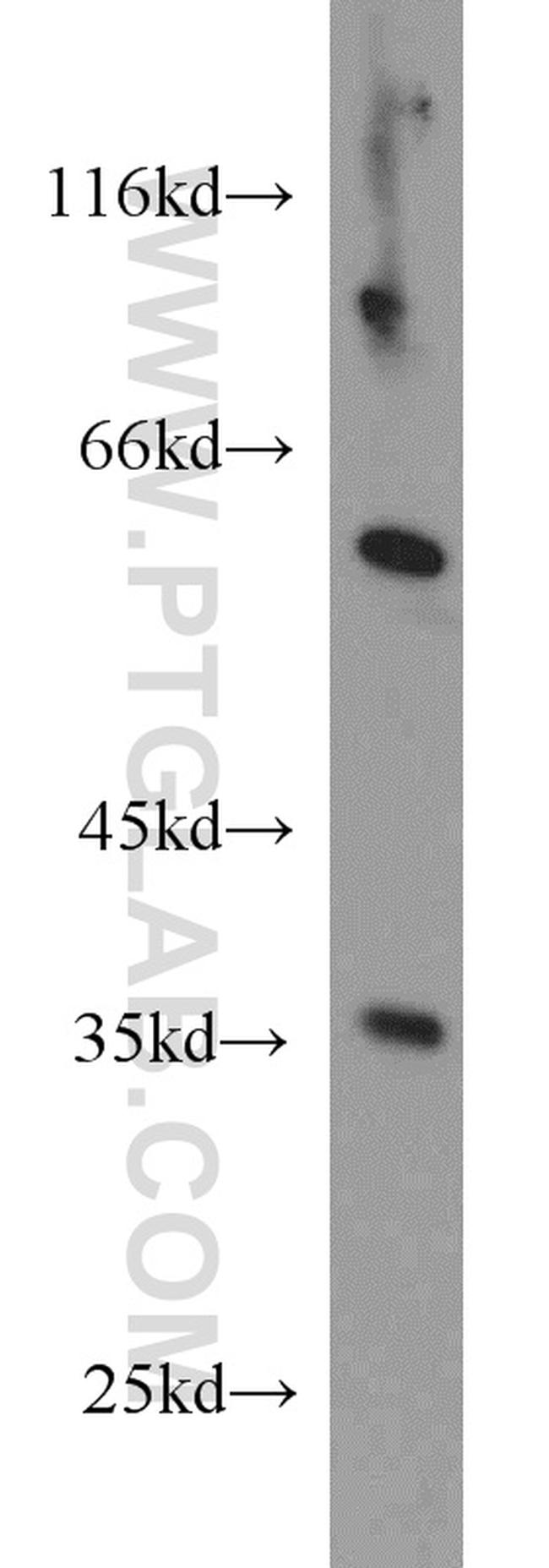 ECH1 Antibody in Western Blot (WB)