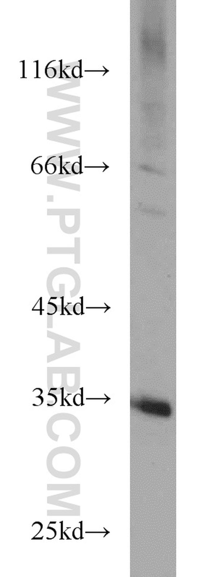 ECH1 Antibody in Western Blot (WB)