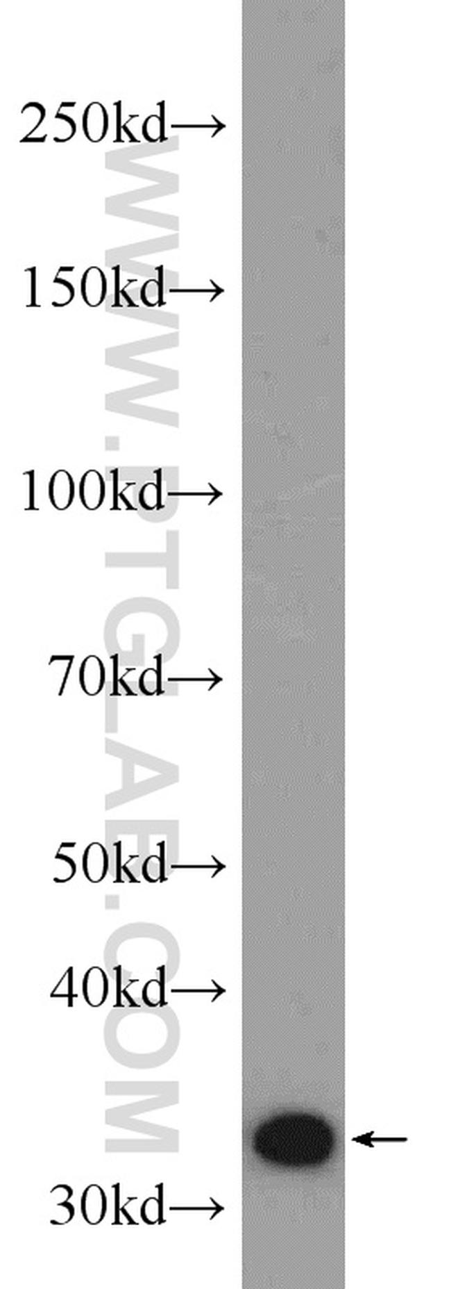 ECH1 Antibody in Western Blot (WB)