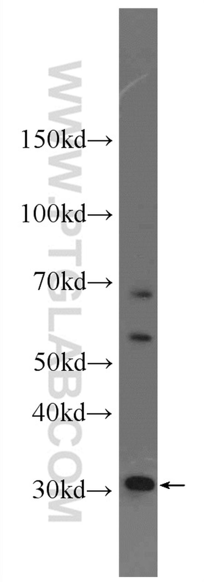 ECH1 Antibody in Western Blot (WB)