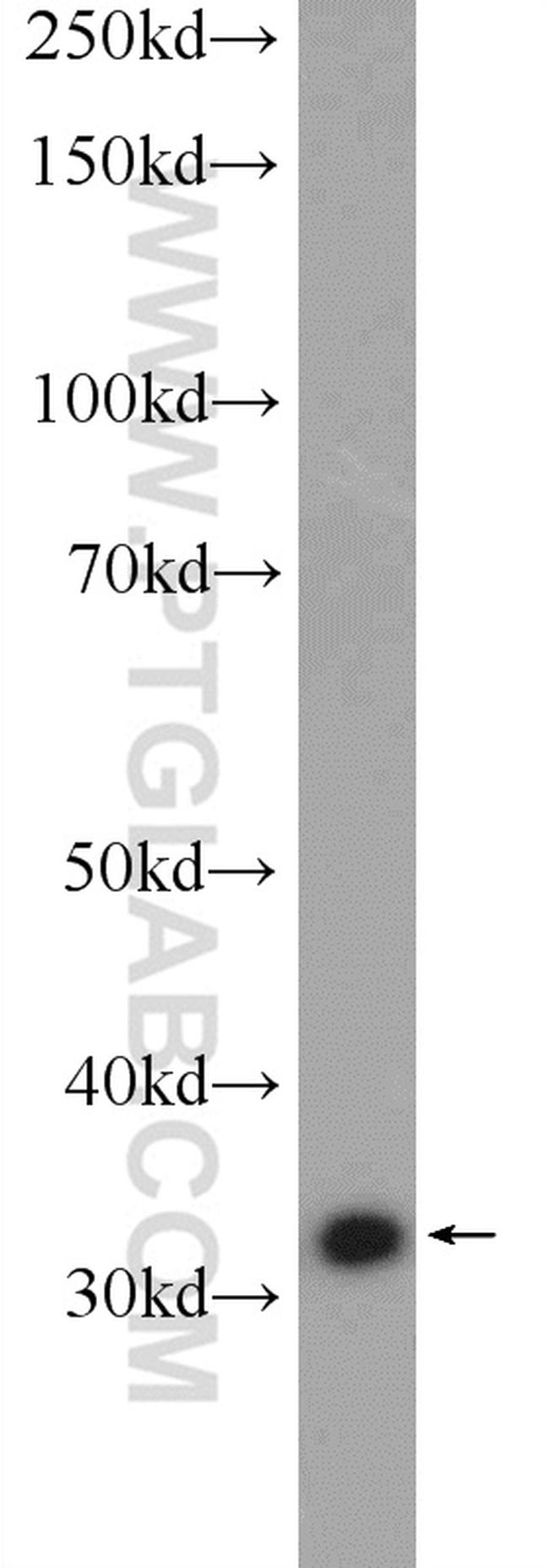 ECH1 Antibody in Western Blot (WB)