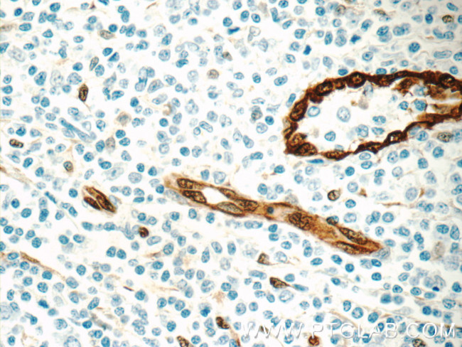 ACKR2 Antibody in Immunohistochemistry (Paraffin) (IHC (P))