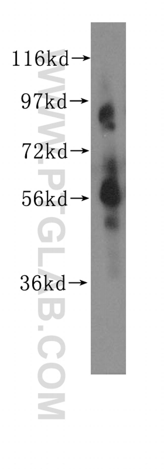 CHRNA6 Antibody in Western Blot (WB)