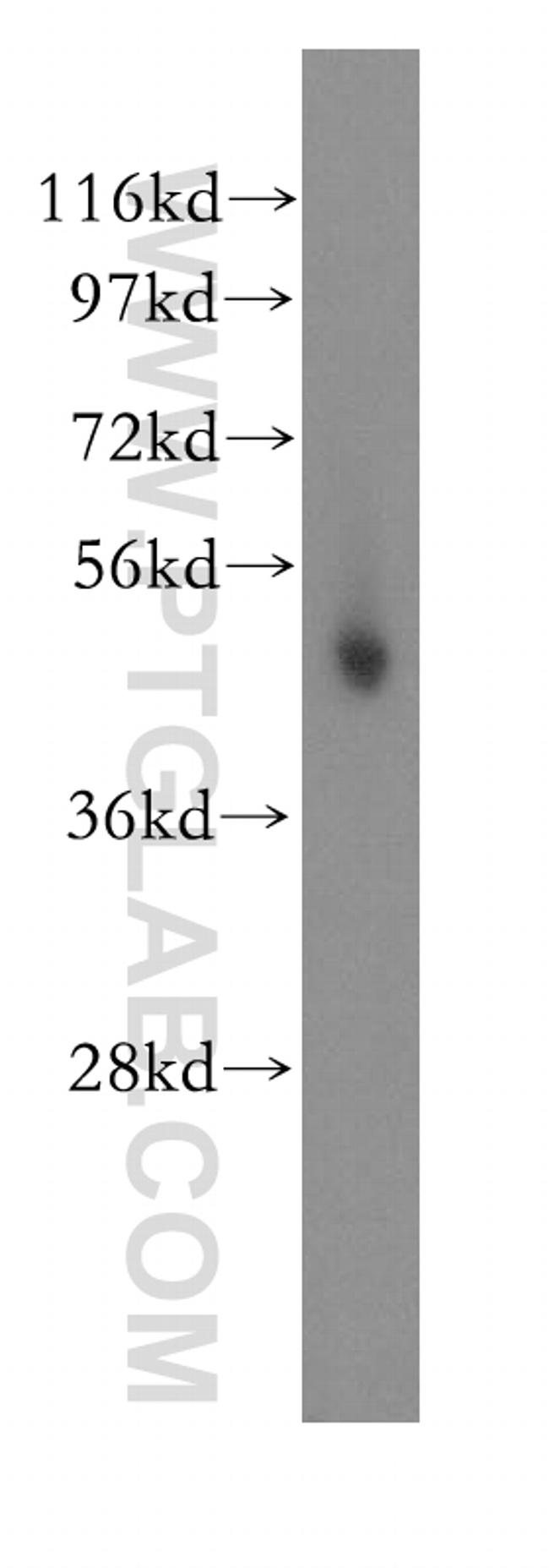 PSMC4 Antibody in Western Blot (WB)