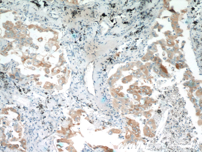 EPCR Antibody in Immunohistochemistry (Paraffin) (IHC (P))