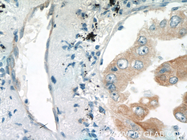 EPCR Antibody in Immunohistochemistry (Paraffin) (IHC (P))