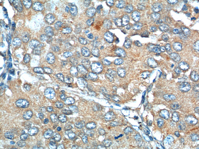 EPCR Antibody in Immunohistochemistry (Paraffin) (IHC (P))