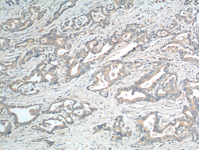 EPCR Antibody in Immunohistochemistry (Paraffin) (IHC (P))