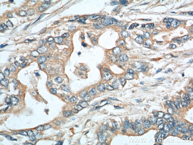 EPCR Antibody in Immunohistochemistry (Paraffin) (IHC (P))