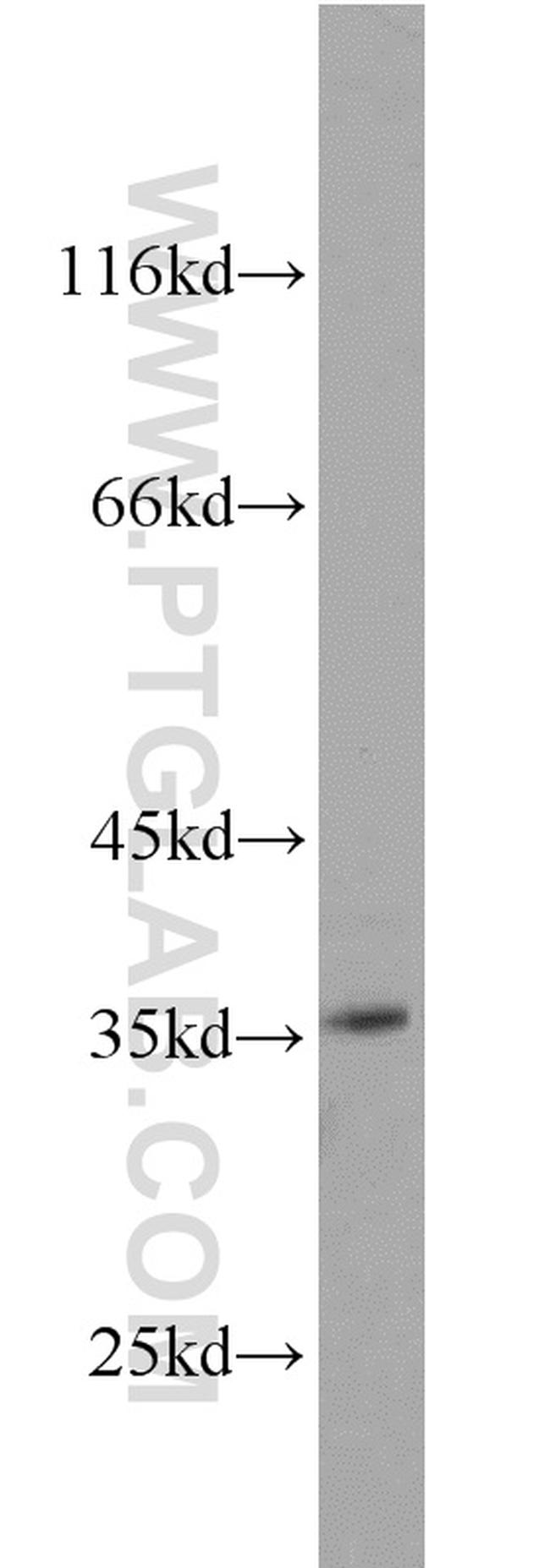 NT5C3 Antibody in Western Blot (WB)