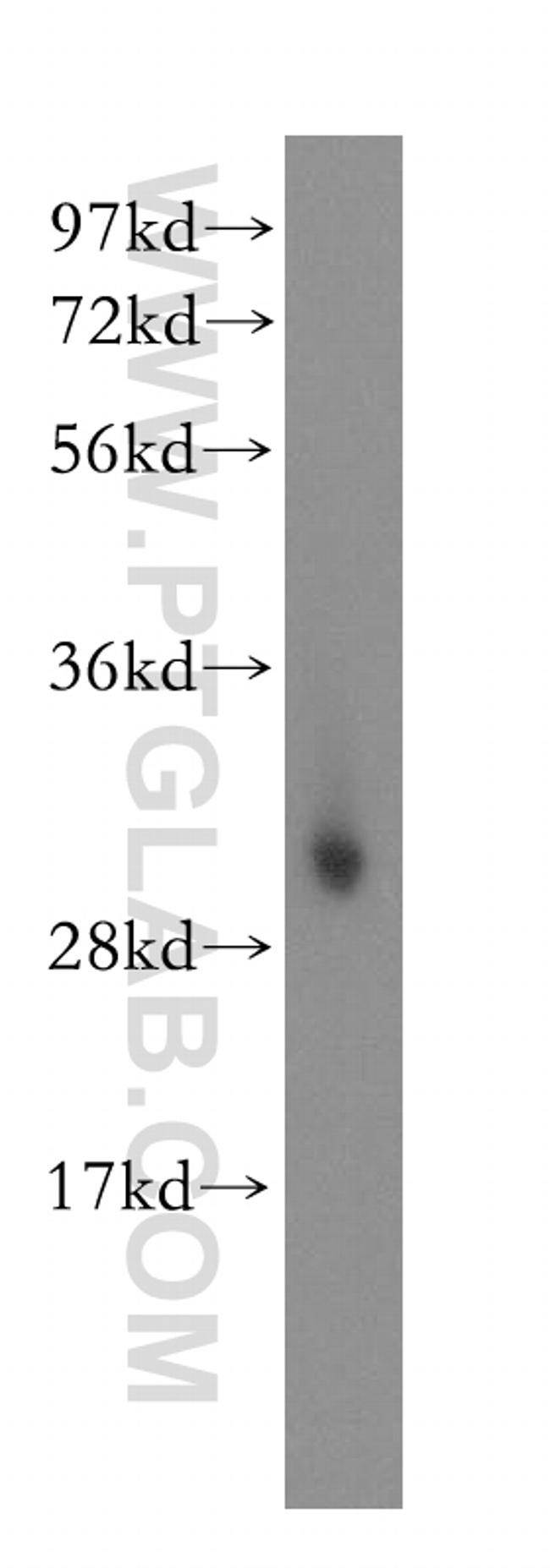 NT5C3 Antibody in Western Blot (WB)