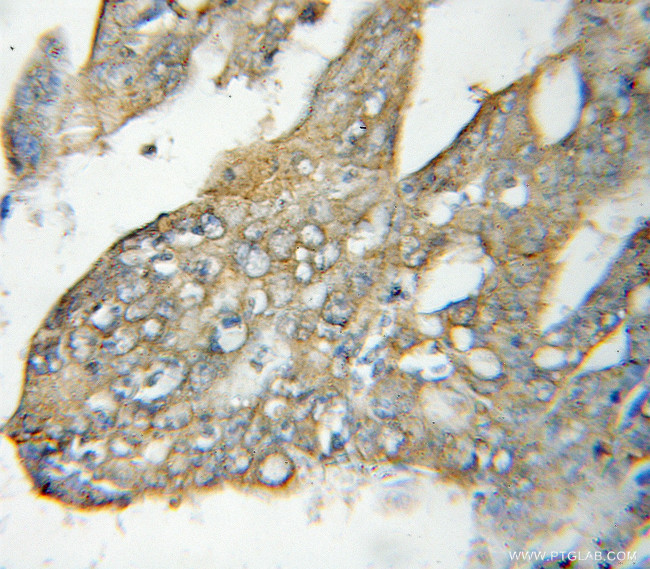 NT5C3 Antibody in Immunohistochemistry (Paraffin) (IHC (P))