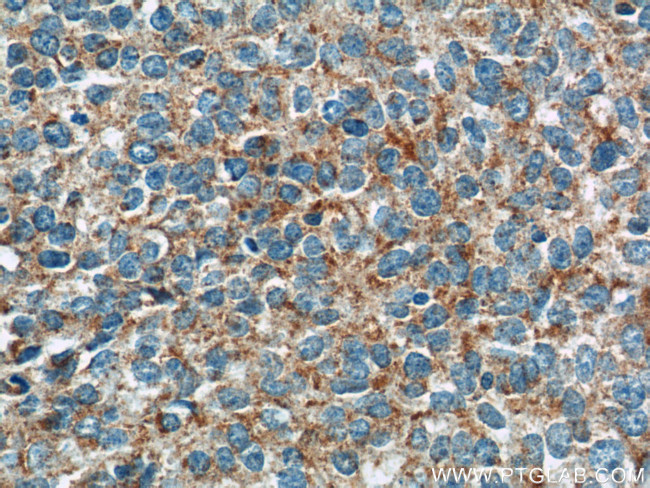 GKAP1 Antibody in Immunohistochemistry (Paraffin) (IHC (P))