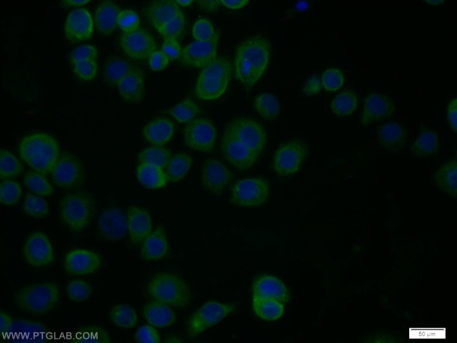 RPH3A Antibody in Immunocytochemistry (ICC/IF)