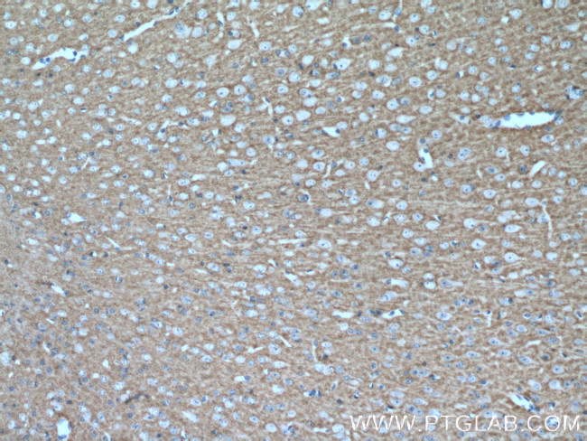 RPH3A Antibody in Immunohistochemistry (Paraffin) (IHC (P))