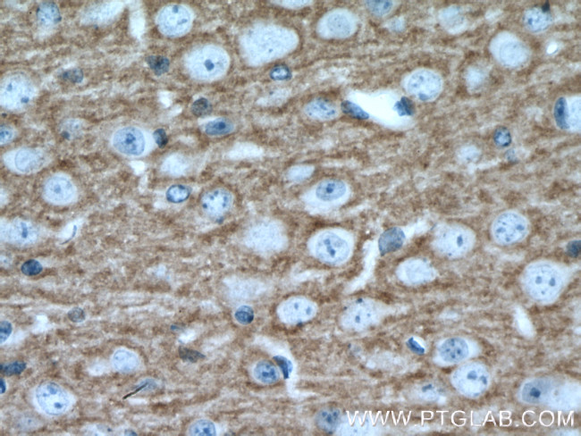 RPH3A Antibody in Immunohistochemistry (Paraffin) (IHC (P))