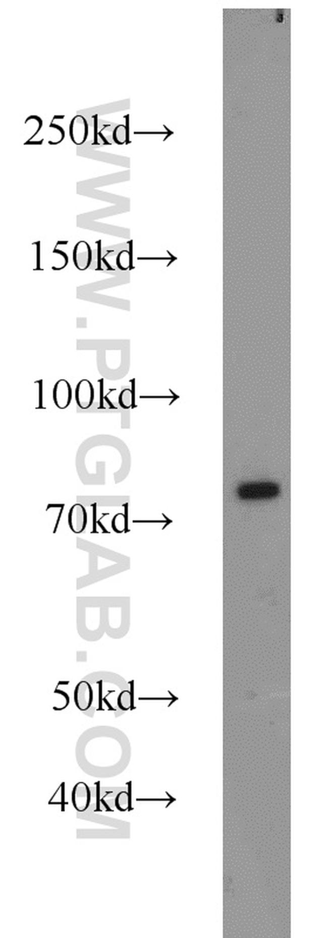 RPH3A Antibody in Western Blot (WB)