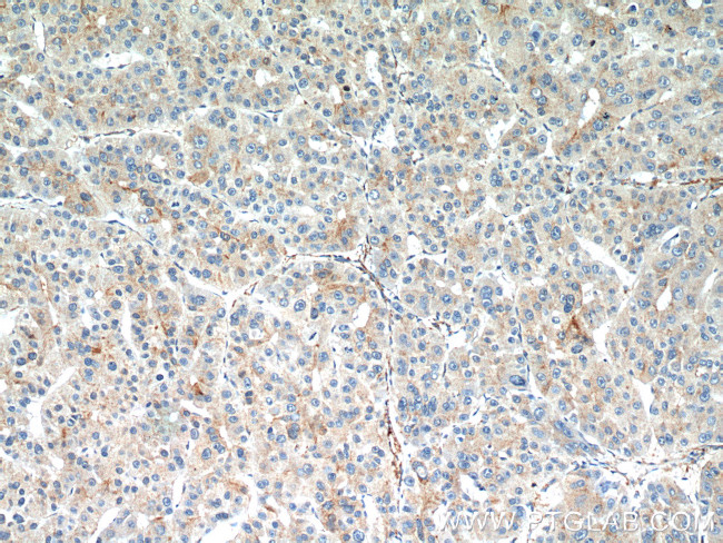 SEPT2 Antibody in Immunohistochemistry (Paraffin) (IHC (P))