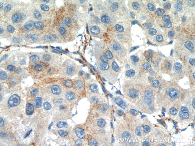 SEPT2 Antibody in Immunohistochemistry (Paraffin) (IHC (P))