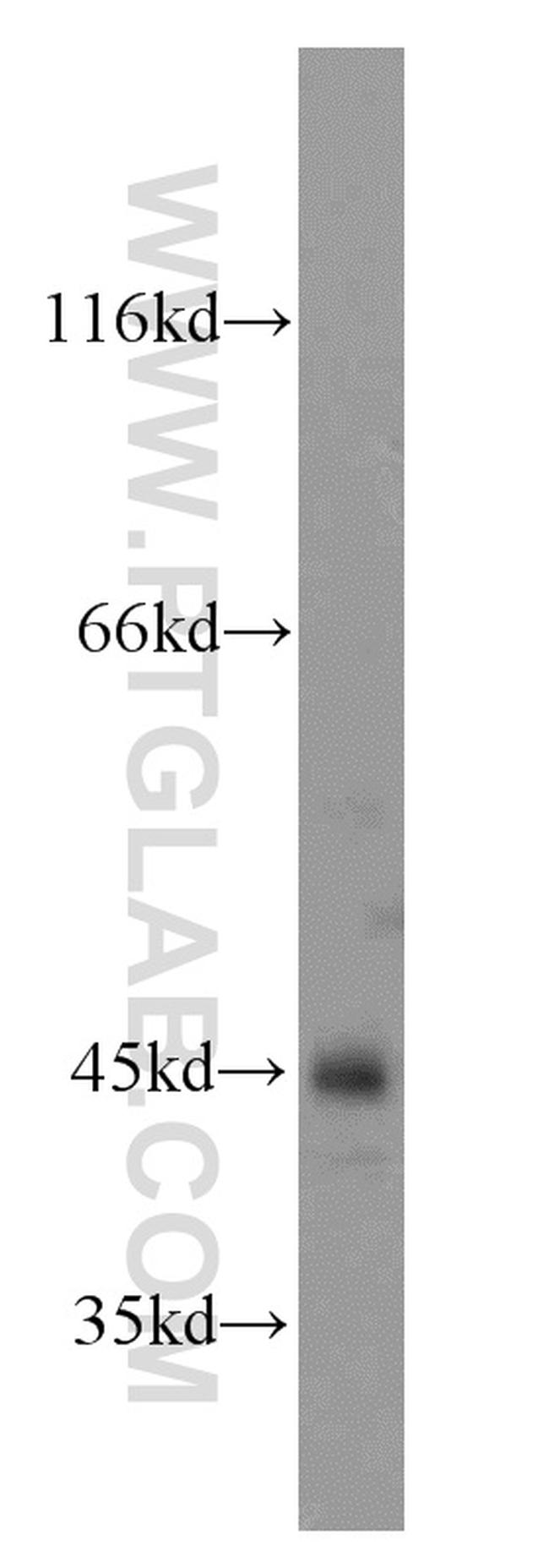 SEPT2 Antibody in Western Blot (WB)