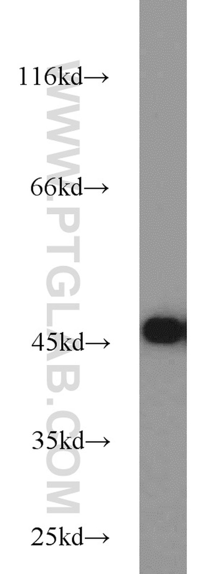 SEPT2 Antibody in Western Blot (WB)