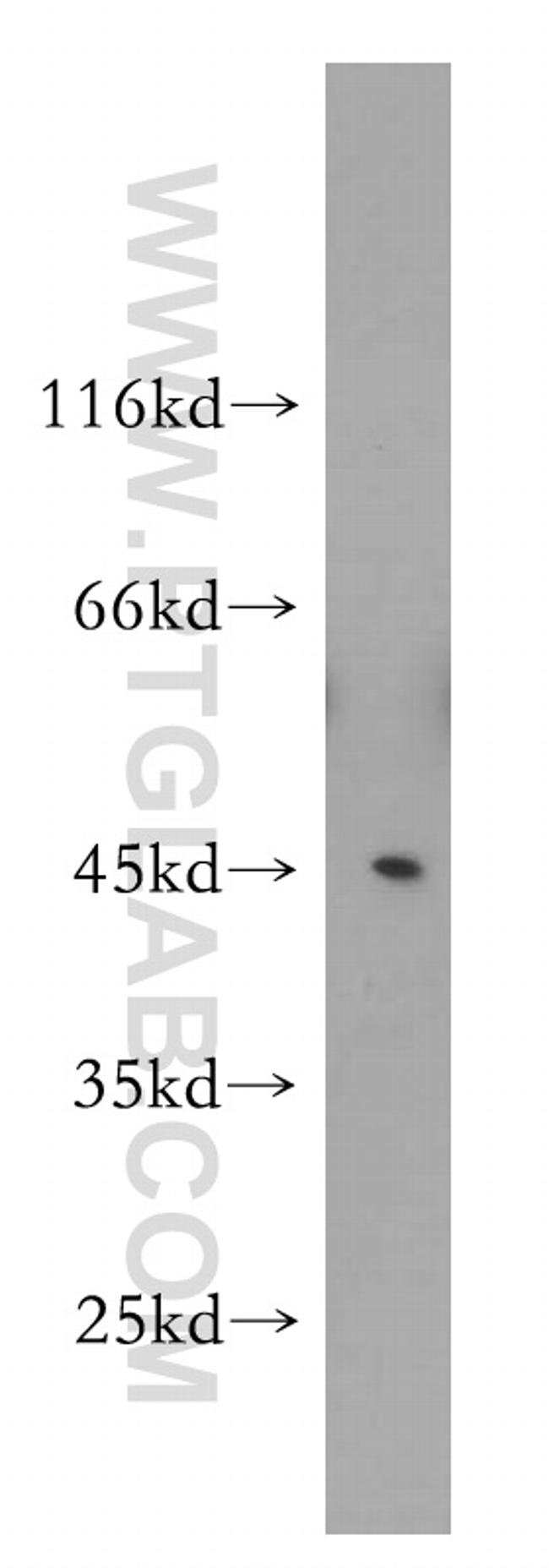 SEPT2 Antibody in Western Blot (WB)