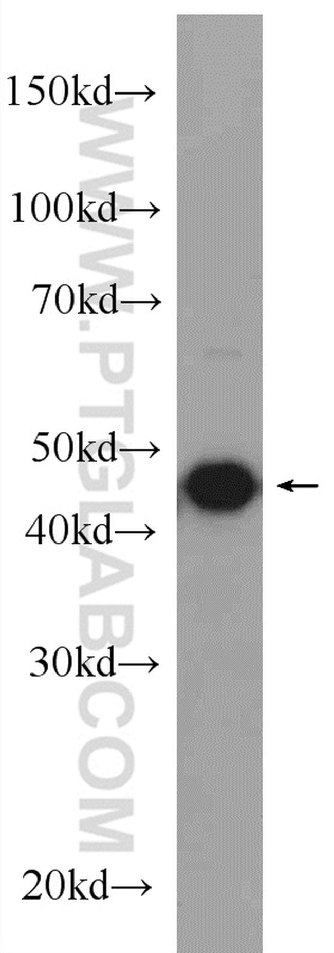SEPT2 Antibody in Western Blot (WB)