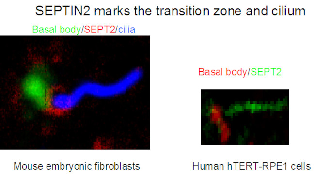 SEPT2 Antibody in Immunocytochemistry (ICC/IF)