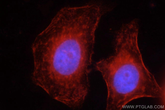 SEPT2 Antibody in Immunocytochemistry (ICC/IF)