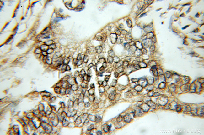 SEPT2 Antibody in Immunohistochemistry (Paraffin) (IHC (P))