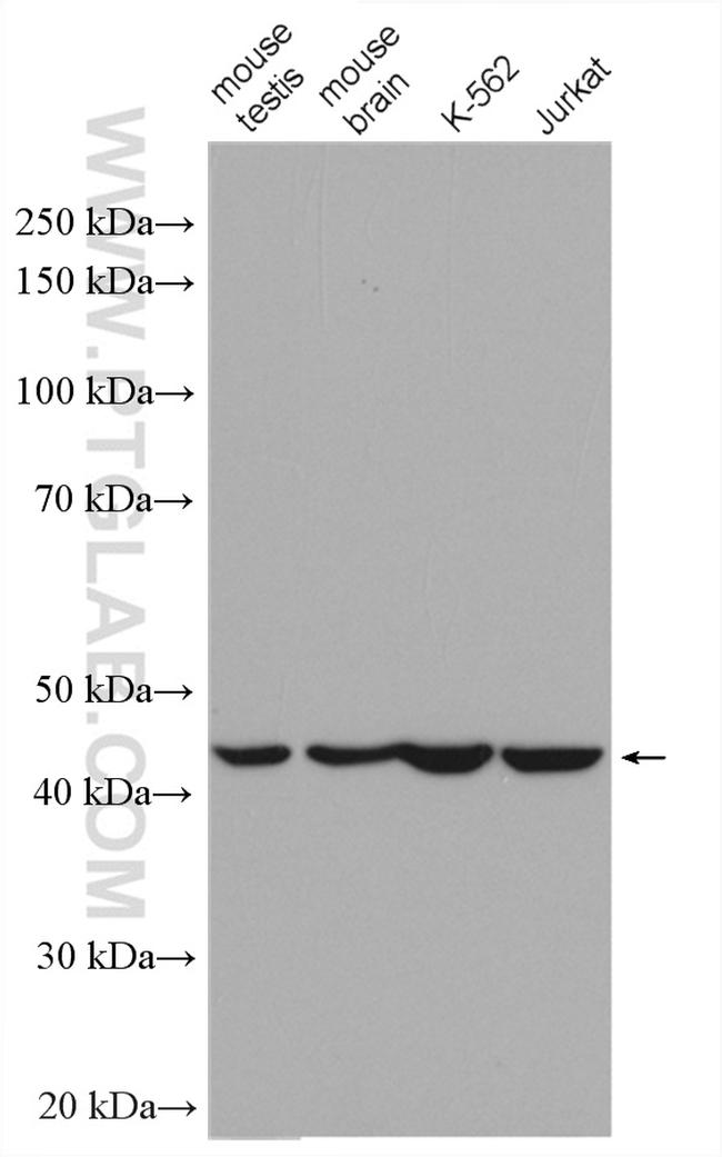 SEPT2 Antibody in Western Blot (WB)