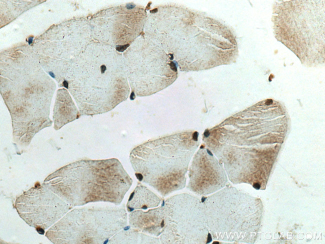 NMNAT1 Antibody in Immunohistochemistry (Paraffin) (IHC (P))