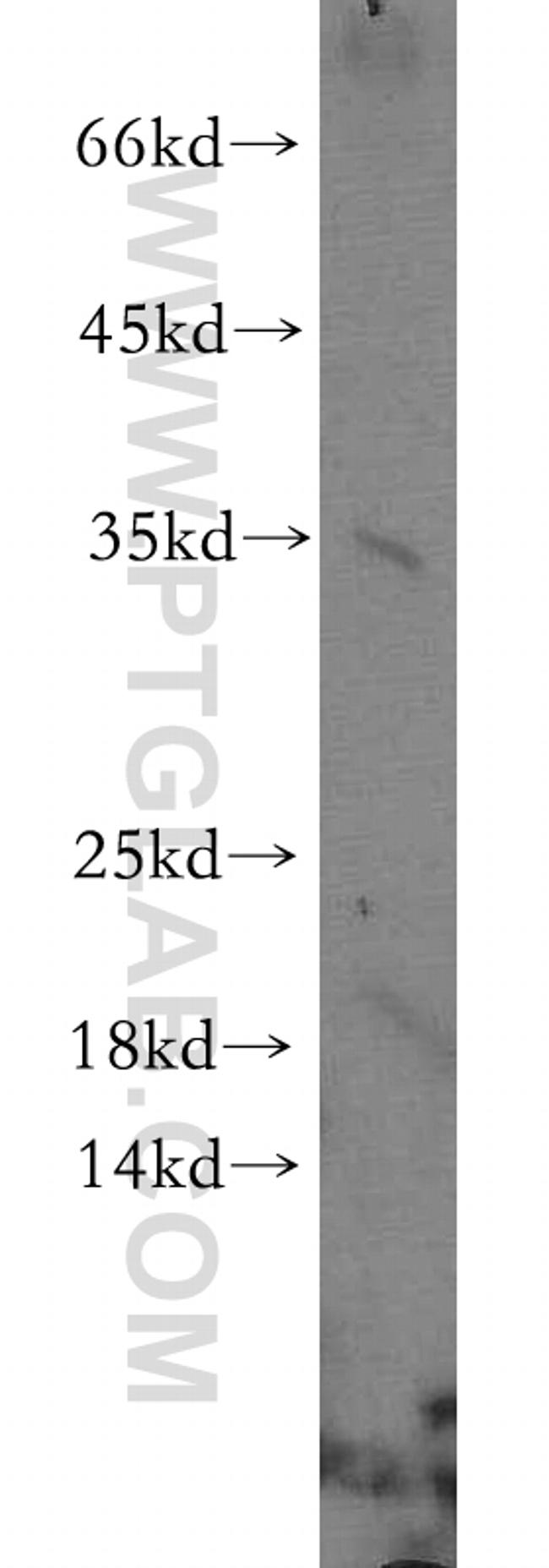 NMNAT1 Antibody in Western Blot (WB)