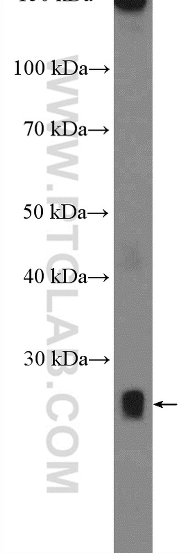 NMNAT1 Antibody in Western Blot (WB)